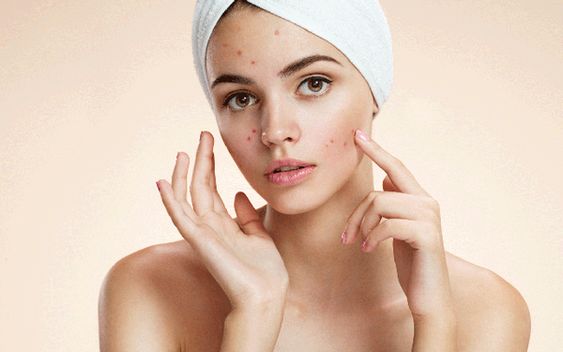 Skincare sau khi nặn mụn: Bí quyết cho làn da mịn màng, không thâm sẹo